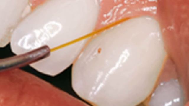 Vibrations & Waves in Dental Hygiene смотреть онлайн