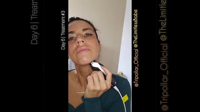 TRIPOLLAR STOP VX 30 Day Skin Reboot Challenge | Day 6 Treatment #3 смотреть онлайн