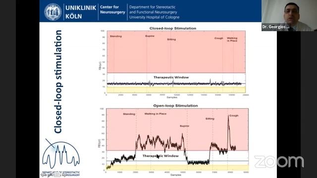 Neuromodulation January 18, 2020 смотреть онлайн