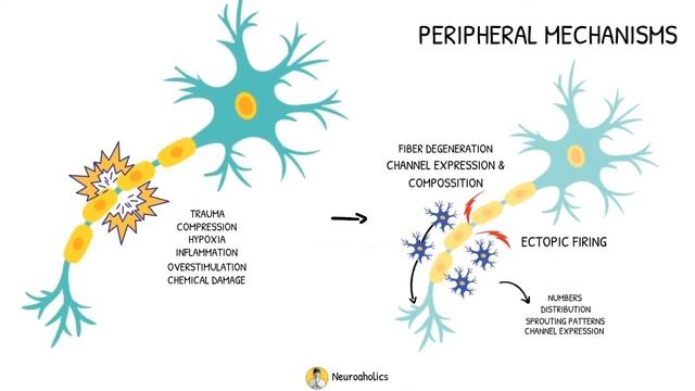 Neuropathic Pain | Central and Perihperal Mechanism | Neuroaholic смотреть онлайн