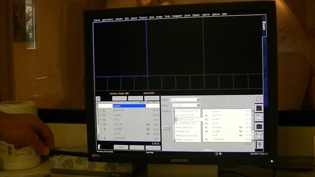 Siemens Avanto start up and shutdown. смотреть онлайн