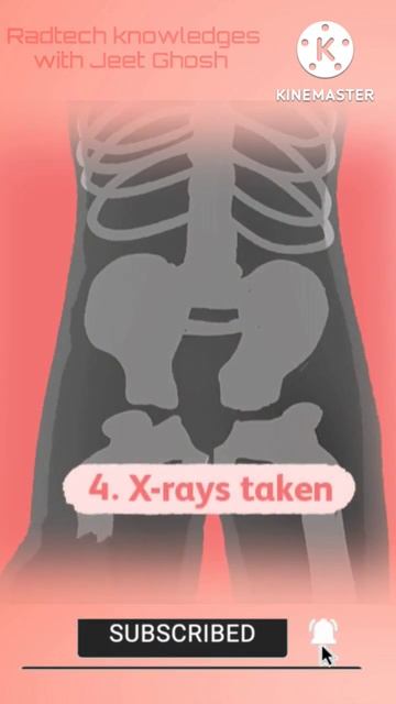 IV Urography #radiology #xray #radiography #mbbsstudent #shorts смотреть онлайн