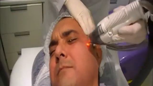 Laser Fracionado Fraxel Dual - Dra Cristina Graneiro смотреть онлайн