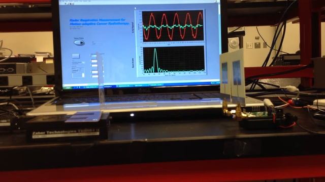 radar vibration measurement смотреть онлайн