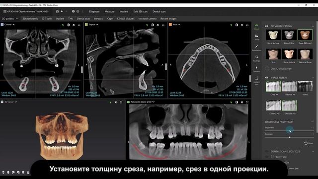 Сохранение пользовательского смарт-макета | DTX Studio Clinic смотреть онлайн