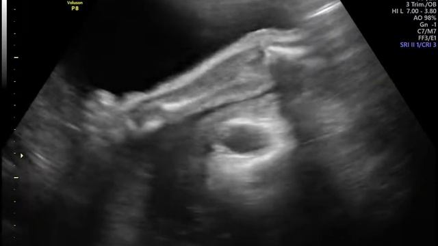 УЗИ ручка) смотреть онлайн