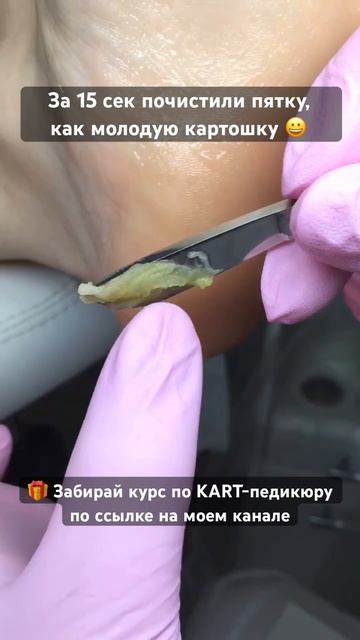 Педикюр KART растворил пятки 😅 Проходи курс по KART-педикюру по ссылке на моем канале #shortvideo смотреть онлайн