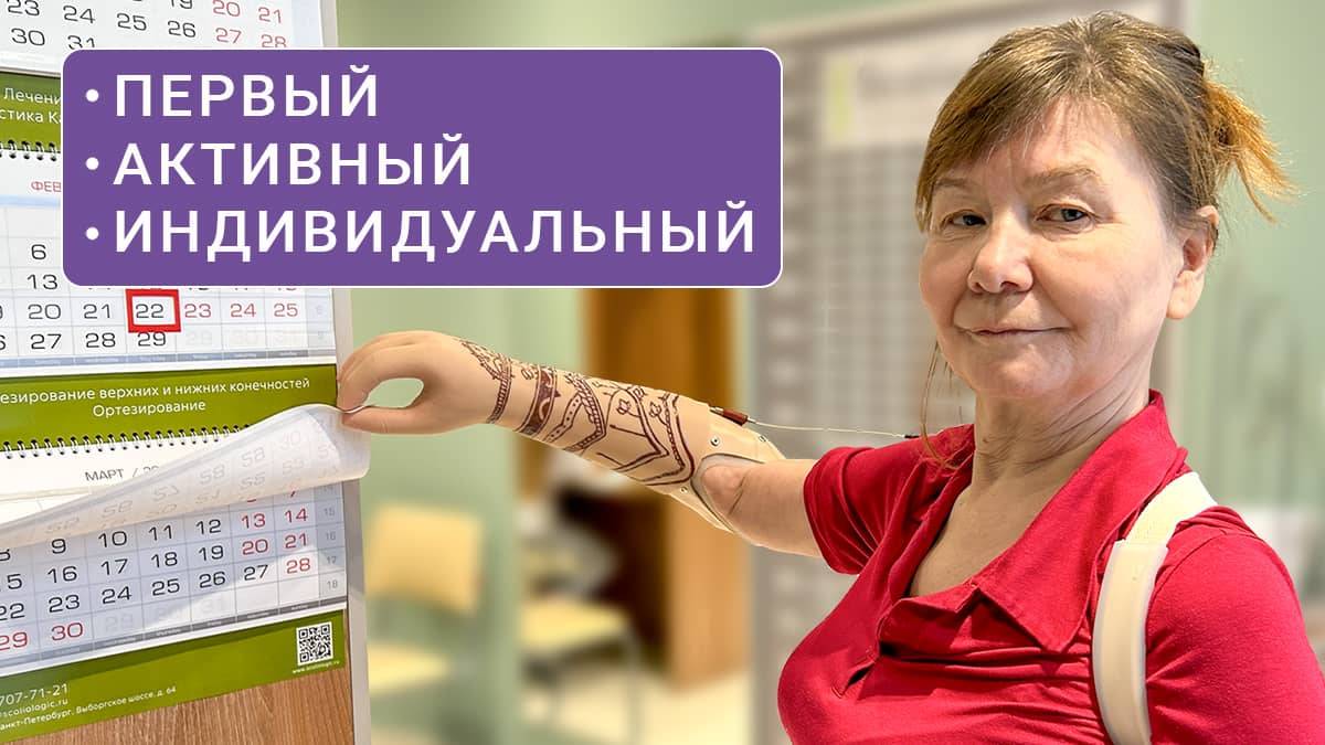 Активный протез с индивидуальным дизайном | История пациента