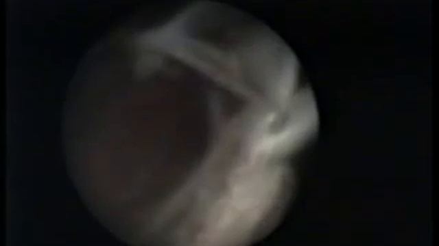 Boscher VIDEO 16 PDR смотреть онлайн