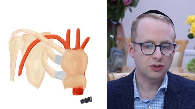 Thoracic Outlet Syndrome Explained смотреть онлайн