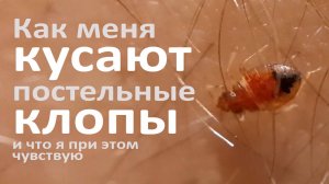 Как меня кусают постельные клопы — взрослые и личинки, и что я при этом чувствую