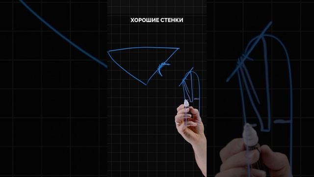 Эндопротез - протез бедра смотреть онлайн