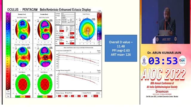 AIOC2022-IC242- Dr. Amit Gupta Real-world applications of Corneal Diagnostics’: A case based appr.. смотреть онлайн