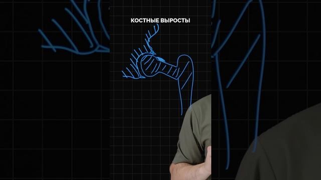 Фемороацетабулярный импинджмент смотреть онлайн