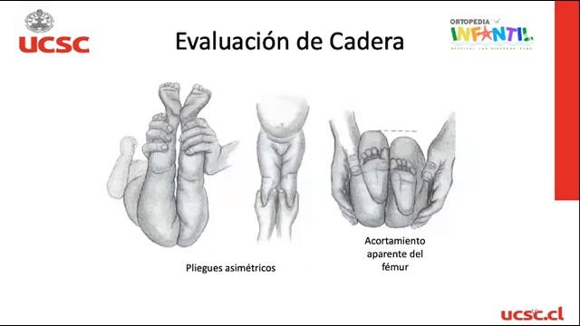Seminarios UCSC - Semiologia En Ortopedia Infantil