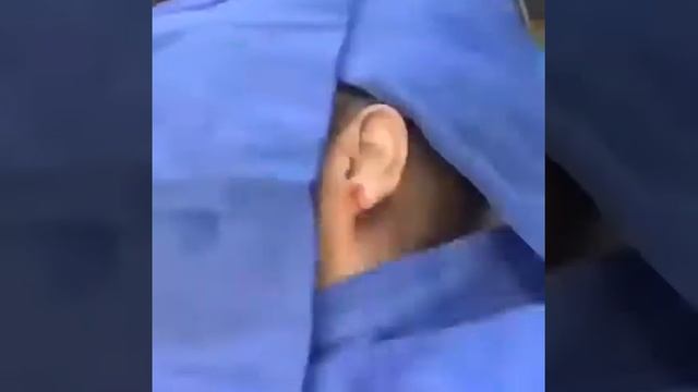 Удаление кисты мочки уха
