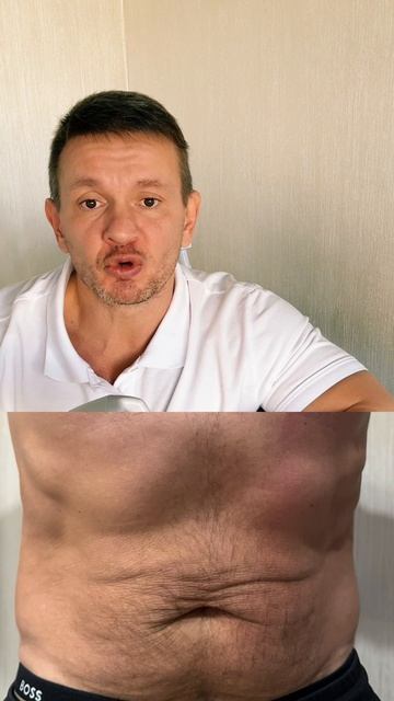 ДО-После exi360 смотреть онлайн