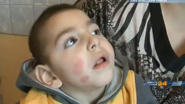«Поможем всем Миром» история маленького Магомеда Гаджимурадова смотреть онлайн