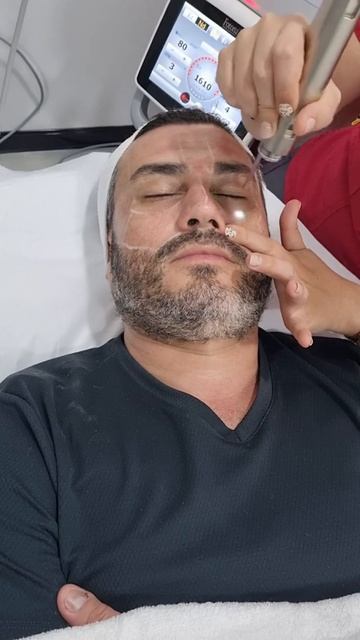 Laser Fotona Timewalker Pro. Descubra lo que puede ofrecer en el cuidado de tu piel смотреть онлайн