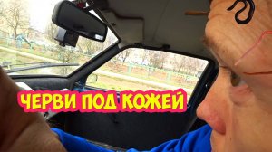 Черви под кожей