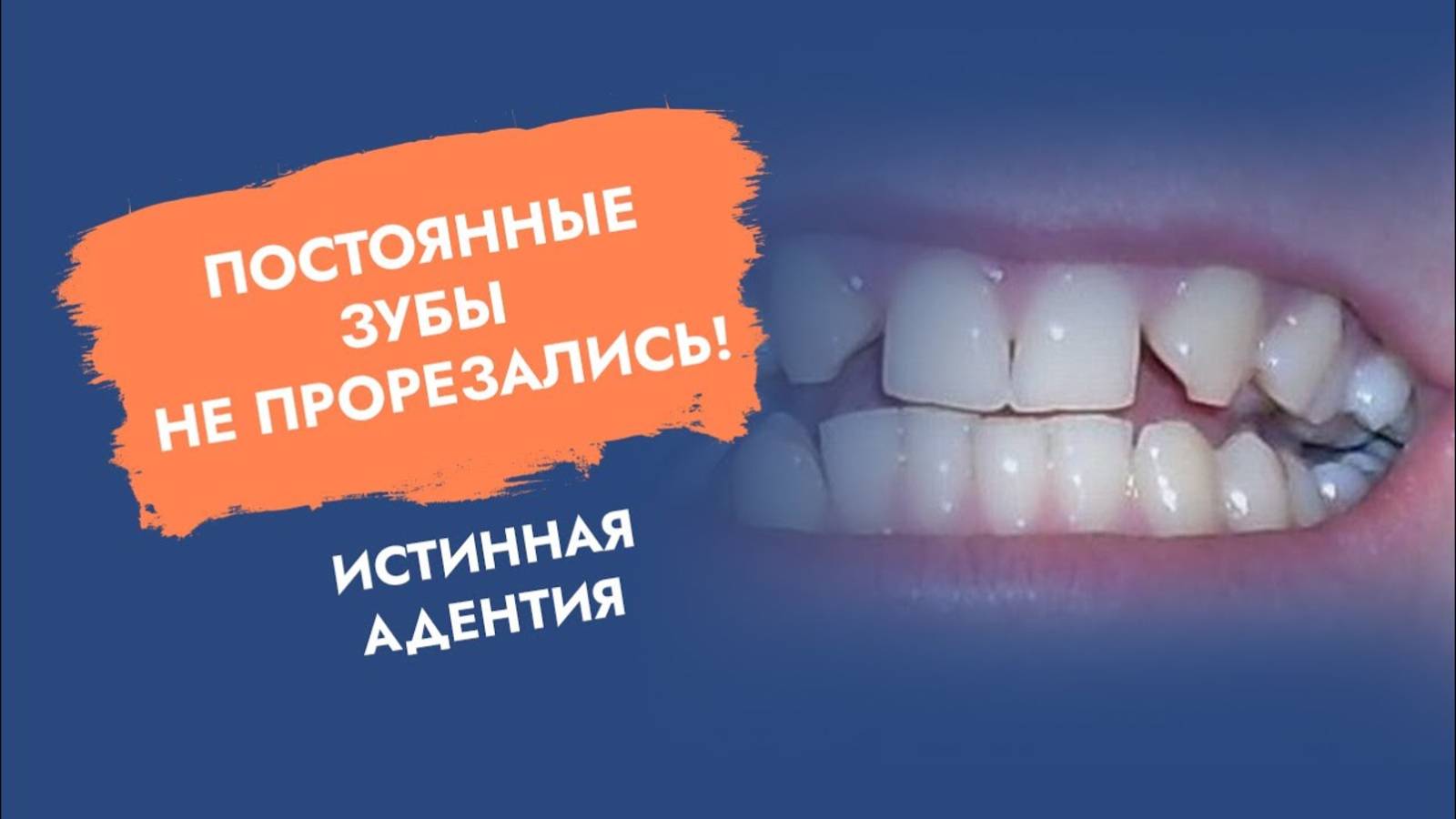 Что делать, если не все постоянные зубы прорезались?