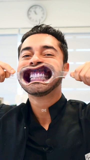 CURAPROX y sus productos pasan la prueba del REVELADOR de placa dentobacteriana #odontologia #short смотреть онлайн