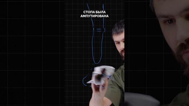 Как устроен протез голени? смотреть онлайн