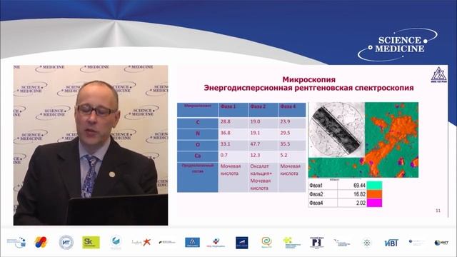 Инновационные методы диагностики и лечения Мочекаменной болезни смотреть онлайн