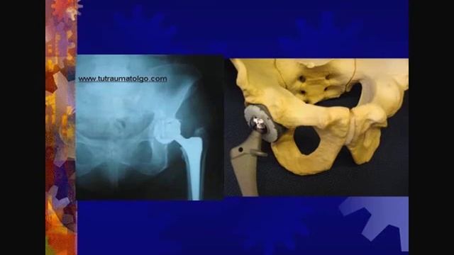 Tmmed Traumatología - 1 6 смотреть онлайн