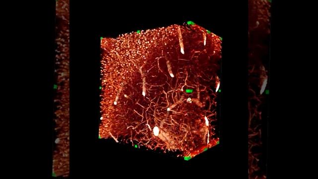 Ultramicroscopy смотреть онлайн