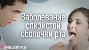 СНЮС  Вред Жевательного Табака  Школьники не оценят