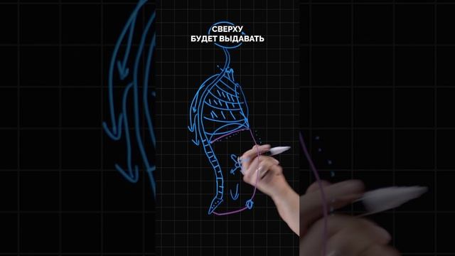 Внутрибрюшное давление смотреть онлайн