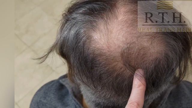 На консультации у хирурга Ивана Двинских🌟 смотреть онлайн