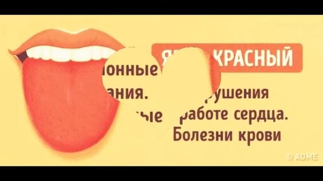 5 проблем, о которых может рассказать цвет языка смотреть онлайн