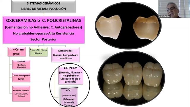 Supervivencia de las restauraciones estéticas, mantenimiento e higiene oral смотреть онлайн