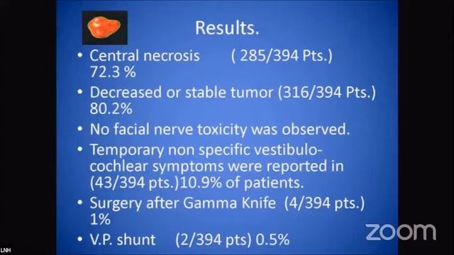 Gamma Knife Radiosurgery for Brain Lesions (A Sattar Hashim) смотреть онлайн