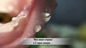 МОЯ ЛЕВАЯ СТОРОНА 2 серия РУССКАЯ ОЗВУЧКА турецкий сериал