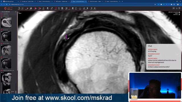 Shoulder MRI Focus Sessions - LIVE смотреть онлайн