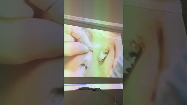 Ebs dermahil смотреть онлайн