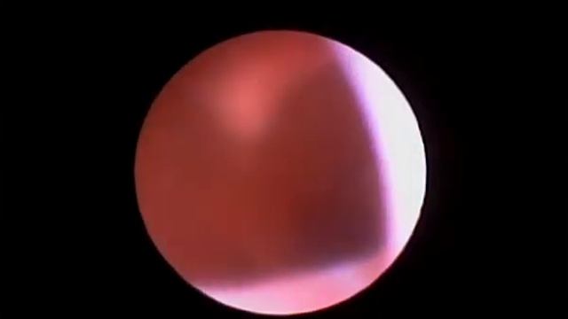 Кот Марсель Риноскопия смотреть онлайн