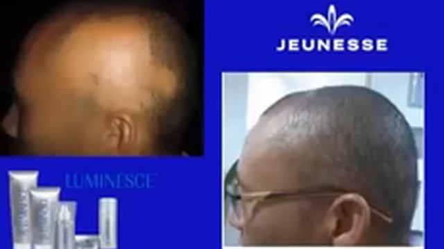 Омоложение лица и тела! Продукция Жанес Глобал Jeunesse Global