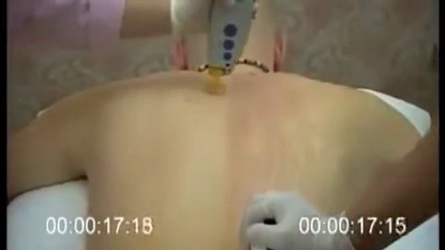 MEDIOSTAR NEXT4 смотреть онлайн