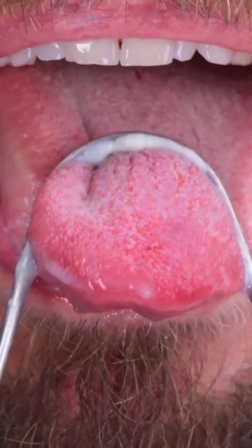 Do you remember to clean your tongue with a scraper? 😱🙈 #shorts смотреть онлайн