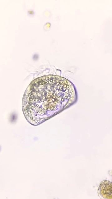 Ostracod #plankton #crustacean #ocean #biology #microscope #science #nature смотреть онлайн