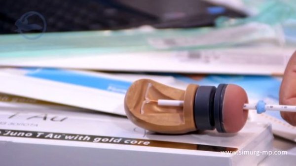 Внутриматочные спирали ЮНОНА и JUNO с системой введения   Симург