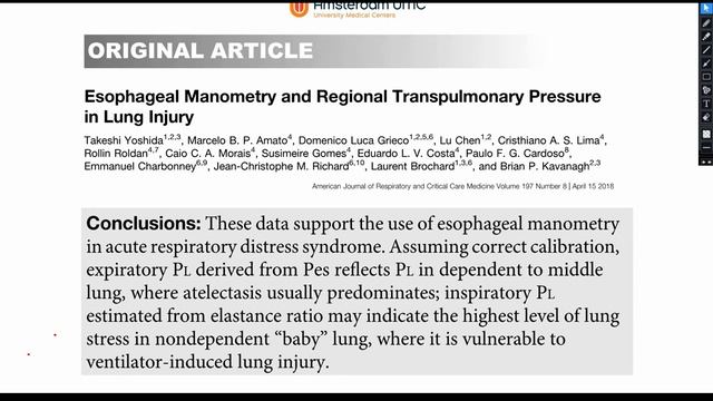 Striking to learn Ventilator settings Leo Heunks 2020