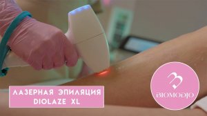 Лазерная эпиляция Diolaze XL в Медицинском центре "Биомоджо"
