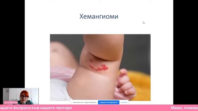 Физиологични състояния при новороденото смотреть онлайн