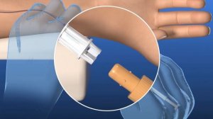 Blood collection: Aspiration with the S-Monovette® (ISO colour code) and Safety-Multifly®-Needle