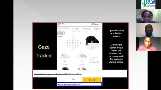 Glaucoma Webinar смотреть онлайн
